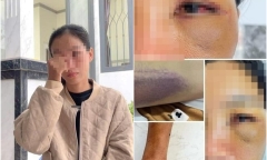 Vụ 2 chị chồng giam lỏng em dâu: Ám ảnh chuỗi ngày bị bạo hành