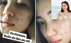 Loại nước giải nhiệt giúp Hòa Minzy 