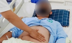 Sốt xuất huyết diễn biến phức tạp, số ca biến chứng, nguy kịch gia tăng