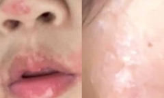 Đi hát karaoke, người phụ nữ nhiễm loại virus 