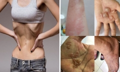 Cẩn trọng với những dấu hiệu nghi nhiễm ký sinh trùng