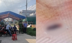 Công an yêu cầu khám nghiệm tử thi người đàn ông tử vong với nhiều nghi vấn