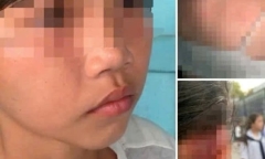 Đình chỉ học tập nữ sinh lớp 6 đánh bạn gây thương tích ở Bình Thuận