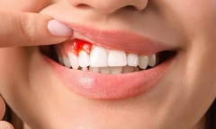 Cô gái 21 tuổi bàng hoàng phát hiện mắc loạt bệnh lý thường gặp ở người 