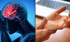 Làm thế nào để phát hiện sớm cơn đột quỵ?