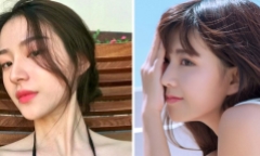 Nếu thuộc nhóm người sau đây, tuyệt đối không nên nâng mũi