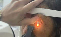 Dùng rượu ngâm hạt na trị chấy, người phụ nữ nhập viện vì bỏng mắt