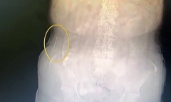 Video: Phát hiện