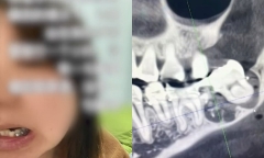Đau đớn vì bác sĩ nhổ nhầm răng, người phụ nữ có quyết định bi thương