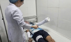 Nam sinh 14 tuổi bị thương nặng do tự chế pháo bằng lưu huỳnh theo video trên mạng