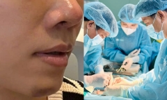 Bi hài hậu vận sau thẩm mỹ: 7 lần đụng đến dao kéo trong 6 tháng, người phụ nữ nhận cái kết đắng