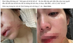 Cận cảnh hình ảnh Hằng Du mục bị chồng Trung Quốc 