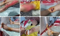 Thực hư thông tin “con tra tấn mẹ bằng cách lấy xe máy kéo lê trên đường” ở Yên Bái