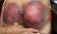 Công an xác minh vụ bé gái 8 tuổi nghi bị bố trói tay vào cột đánh đập 