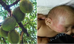 Tin tức đời sống mới nhất ngày 4/8/2019: Bé trai 4 tháng tuổi nhập viện cấp cứu vì bị sầu riêng rơi trúng đầu