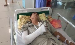 Ông già 61 tuổi bị nhóm thanh niên vô cớ đánh gãy tay, vỡ xương gò má