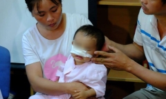 Bé trai 1 tuổi bị chó nhà nuôi cắn rách mặt, mất mũi