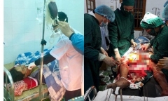 Ngân hàng máu sống cứu kịp thời ngư dân bị sắt đâm thấu đùi, mất 2 lít máu
