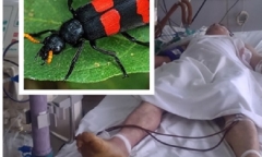 Thương lái Trung Quốc mua sâu ban miêu, nhiều người nguy kịch cấp cứu