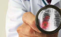 Chuyên gia Nga nêu triệu chứng tổn thương nguy hiểm nhất do virus corona mới gây ra