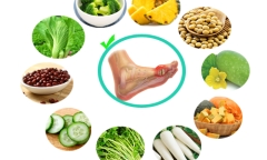 Những thực phẩm mà người mắc bệnh gout nên tránh xa