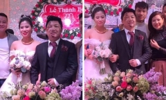 Quá chén trước ngày cưới, chú rể bị ngã sưng húp mặt nhưng vẫn cười tươi cạnh cô dâu