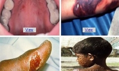Tin tức bệnh Ebola mới nhất:Những điều cần biết về thuốc đặc trị
