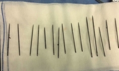 15 cây kim trong niệu đạo của quý ông