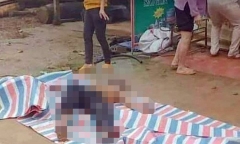 Làm rõ vụ đôi nam nữ nghi ngoại tình bị bỏng nặng trong vụ hỏa hoạn