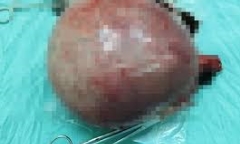 Cô gái mắc bệnh kỳ dị nhất thế giới được phẫu thuật thành công