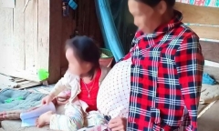 Mang thai 14 năm, người phụ nữ 'đẻ' ra khối u nặng 25kg