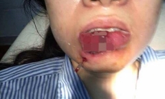 ‘Thần dược’ tràn lan, người bán tư vấn làm đẹp kiểu... ‘khép kín’!