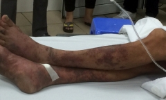 Tin tức đời sống mới nhất ngày 30/6/2019: Mổ lợn chết làm cơm, người đàn ông 48 tuổi tử vong