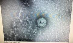 Việt Nam nuôi cấy và phân lập thành công virus corona