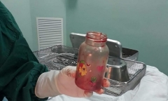 Hãi hùng người đàn ông nhét bình sữa vào hậu môn để chữa thoái hóa cột sống