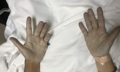 Da người phụ nữ đột nhiên chuyển màu xanh sau một trận đau răng