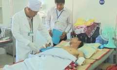 Tai nạn lao động, người đàn ông bị đứt lìa 2 cánh tay