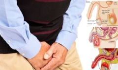 Hé lộ nguyên nhân phổ biến gây viêm mào tinh hoàn khiến nam giới có thể vô sinh