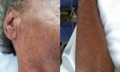 Cụ bà 84 tuổi tử vong vì bị hàng trăm con ong đốt