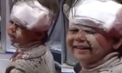 Dân mạng bật khóc trước clip cô bé Syria mặt rớm máu vẫn mỉm cười