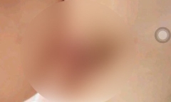 Vụ bé trai 2 tuổi nghi bị cô giáo “cắt vùng kín
