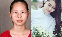 Nữ sinh sư phạm từng mặc cảm với gương mặt xấu xí bỗng 'lột xác' hóa 'thiên nga'