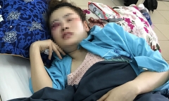 Yêu cầu kiểm điểm trưởng công an phường dùng xe công đón người hành hung ở quán bánh xèo