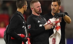 Rooney chảy máu, khâu 5 mũi sau khi ghi bàn thắng đầu tiên cho DC United