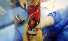 Tin tức đời sống mới nhất ngày 7/1/2019: Bình xịt phòng mắc kẹt trong trực tràng nam bệnh nhân