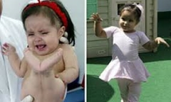 Giải mã hội chứng lạ