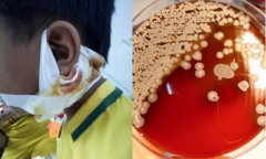 Tin tức đời sống mới nhất ngày 23/9/2019: Lại thêm một trường hợp nhiễm vi khuẩn
