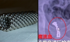 26 viên bi được nhét trong 