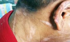 Lời kể đẫm nước mắt của cô gái bị đánh đập tàn nhẫn chạy chốn khỏi 