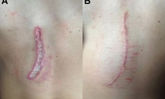 Tin tức đời sống mới nhất ngày 21/11/2019: Bé gái suýt chết vì điện thoại đang sạc rơi vào bồn tắm